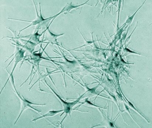 Dendritische Zellen/Crystal Zapper